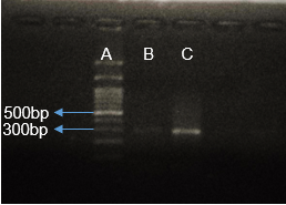 الشّكل (2). منتج الـ PCR باستعمال زوج المشارع الوارد في الأدبيّات. A: سلم مئوي لأطول قطع الـ DNA، B: عينة بدرجة تلدين ⁰C 64 وفق شروط Rafiee et al، C: ذات العينة بدرجة تلدين ⁰C 60 تظهر المنتج المطلوب مع لطاخة منتجات ثانويّة.